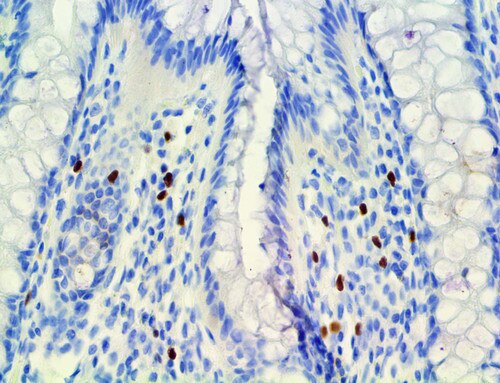 IHC of FOXP3 on an FFPE Colon Tissue